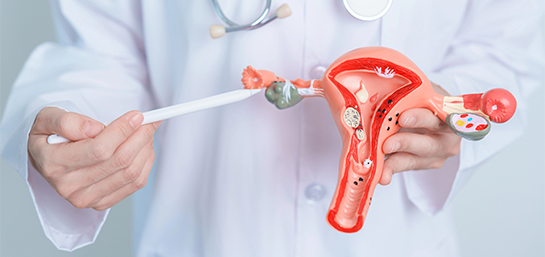 ¿Cubre el Seguro de Salud MAPFRE la detección y tratamiento del cáncer de ovario?