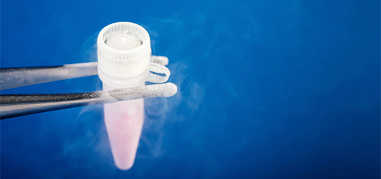 Conservación de células madre en el seguro