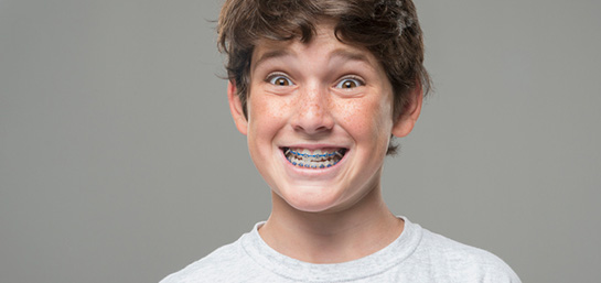 ¿Qué tipos de ortodoncia existen y cómo elegir la adecuada?